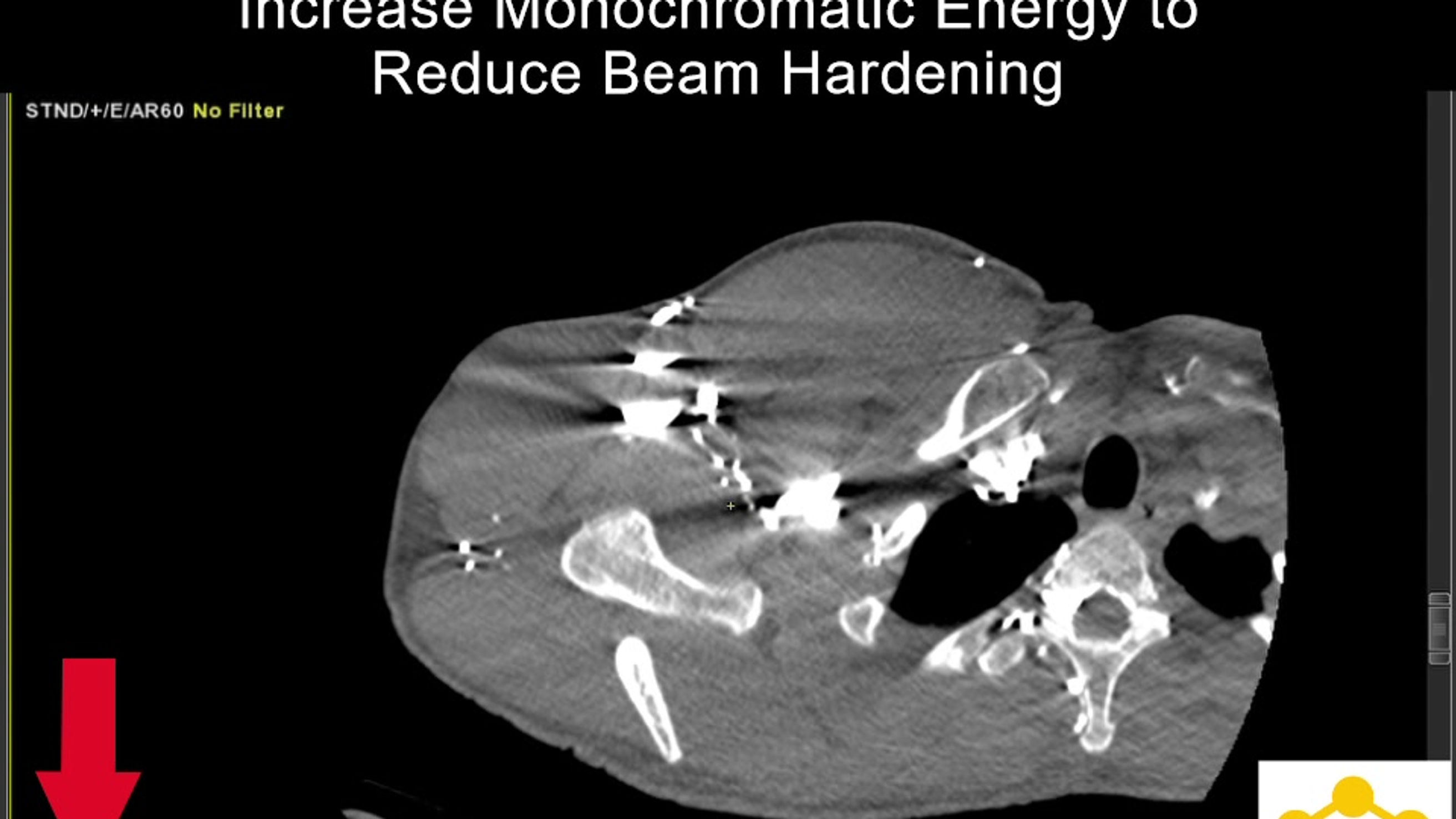 Case 24: DECT for Direct CTV